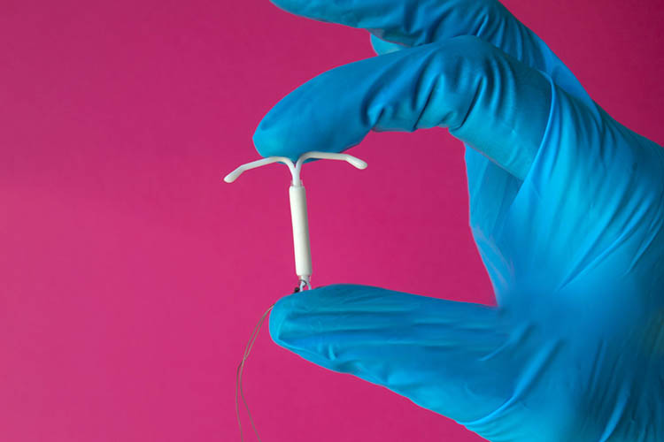 آی یو دی میرنا یکی از رایجترین انواع آی یو دی های هورمونی است.